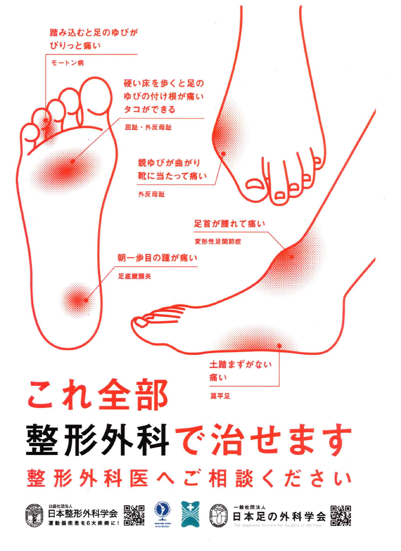 足の症状は整形外科へご相談ください